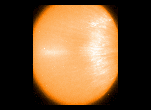 First Light with the Soft X-ray Telescope (SXT) for ASTROSAT